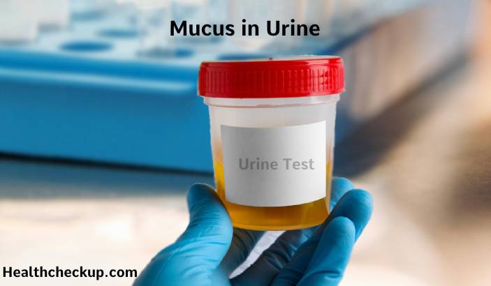 What does Mucus in Urine mean in Males and Females?