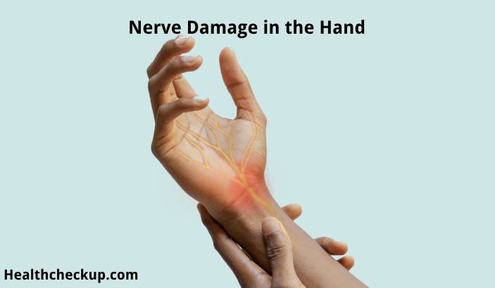 Nerve Damage in the Hand: Symptoms, Causes, and Treatment