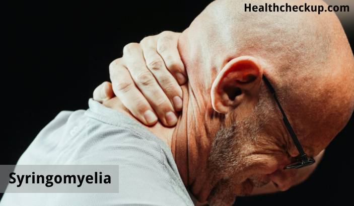 Syringomyelia: Symptoms, Causes, Treatment, Life Expectancy