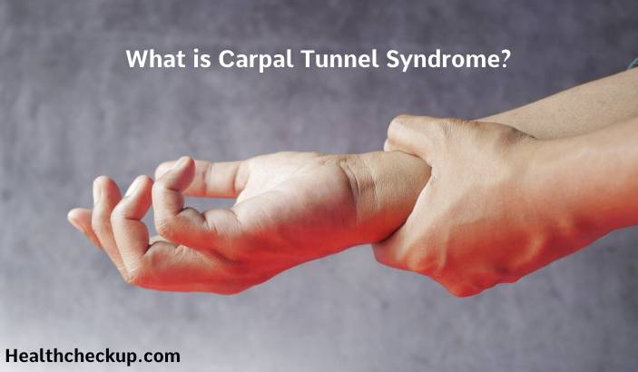 Carpal Tunnel Syndrome: Symptoms, Causes, Tests, Treatment, and Precautions