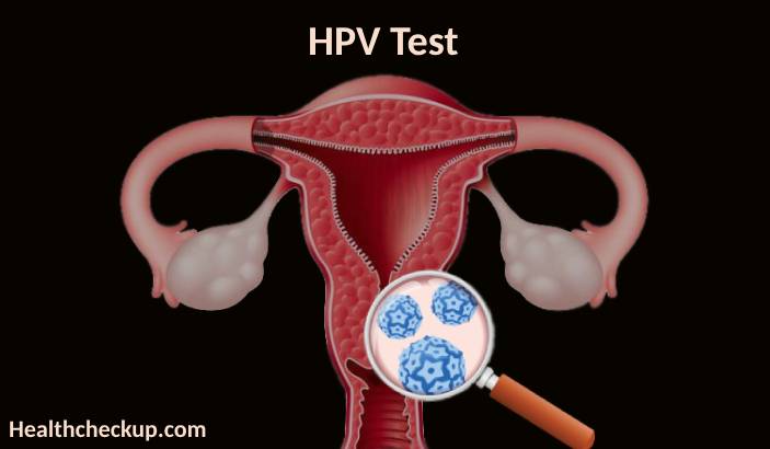 Human Papillomavirus (HPV) Test: Purpose, Preparation, Procedure, Results, and Risks